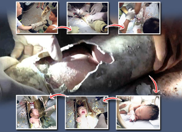 Bayi Terjepit di Pipa Toilet Berhasil Diselamatkan